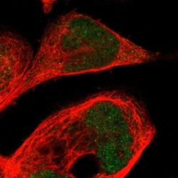 CPED1 Antibody, Novus Biologicals 25 &mu;L, Unlabeled:Antibodies, Polyclonal